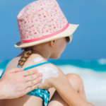 How to Get Rid of Sunburn Fast and Restore Your Skin